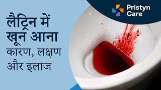 लैट्रिन में खून आना - कारण, लक्षण और इलाज | For Free appointment call: 9821-388-242