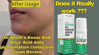 Dr Sheth's Kesar And Kojic Acid daily pigmentation correction  Cream to Treat Hyperpigmentation