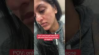 Taking Action: Starting Acne Treatment with a Dermatologist #acne #acneskin