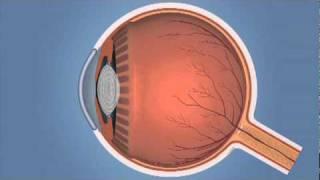 How the Eye Works and Glaucoma