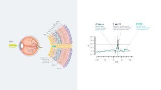 RETeval: The ERG Waveform