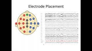 Understanding the EEG