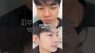 피부과 도움 없이 얼굴 새하얘지는 방법 #미백 #화장품 #기초케어 #미백크림 #추천