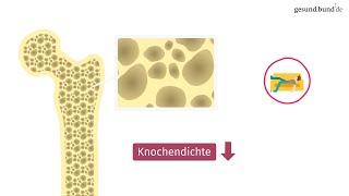 Wie entsteht Osteoporose?