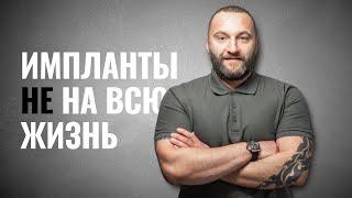  Что такое зубной имплант и нужно ли его устанавливать?