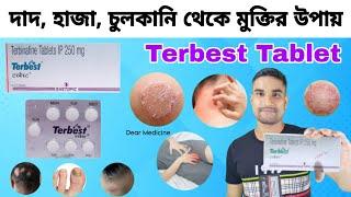 Terbest 250 tablet uses in bengali | Terbinafine tablets benefits and side effects | Terbest tablet.