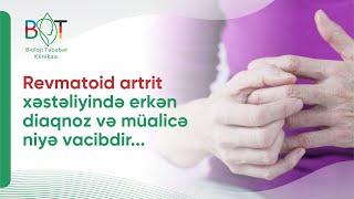 Oynaq ağrısı və şişkinlik, hərəkət məhdudiyyəti - Revmatoid #artrit xəstəliyinin əsas simptomları