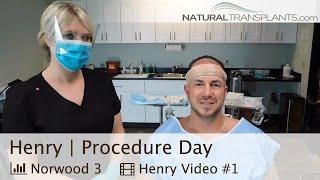 Hair Transplantation Surgery Video | Hair Transplantation in USA (Henry)