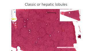 Histology with Chimmalgi: Liver