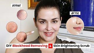 ULTIMATE DIY SCRUB TO GET RID OF BLACKHEADS I PORE CLEARING I SKIN BRIGHTENING