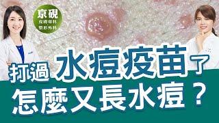 打過水痘疫苗了，怎麼又長水痘？【京硯皮膚科診所】