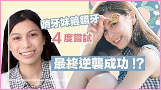 bribriana │[5年箍牙心得] 哨牙妹箍錯牙！最終成功逆襲！？？(多圖)