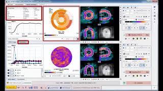 PCARD Tool for PET Cardiac Modeling (Overview)