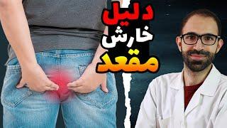 چطور انگل و کرم روده را از بین ببریم؟ | علائم کرم روده | درمان خانگی کرمک