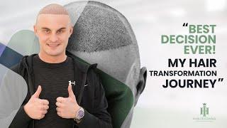 "Hair Transplant with Hair of Istanbul: How It Changed My Life!"