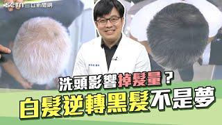 白髮變黑不是夢！4招養出「烏黑秀髮」洗頭影響掉髮量？皮膚科名醫曝關鍵｜台灣髮王皮膚專科醫徐常捷｜主持人許晶晶｜奕起聊健康｜祝你健康