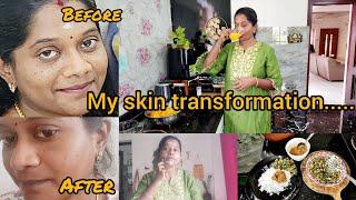 🪷My skin transformation‍️எல்லாருடைய வாழ்க்கையிலும் பிரச்சனை இருக்கும்youtube vs realityJan 30