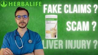 Doctor Reviews Herbalife - The Truth Exposed