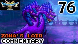 A Dramatic Moment: Dragon Quest III Remake - Part 76 - A Discovery In Zoma's Citadel