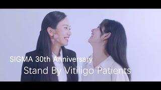 SIGMA 30th Anniversary Special: Stand By Vitiligo Patients