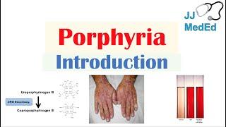 Introduction to Porphyria | Porphyria Cutanea Tarda vs. Acute Intermittent Porphyria