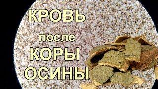 Кровь после коры осины. Работает