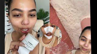 Best blackhead and whitehead removal! ​⁠