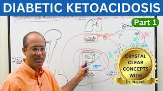 Diabetic Ketoacidosis | Symptoms | Causes | Diagnosis | Part 1 ‍️