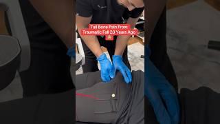 Tailbone *COCCYX* Pain From Fall 20 Years Ago