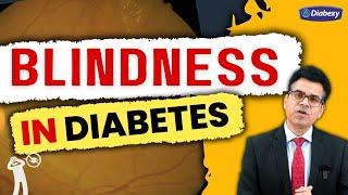 Blindness In Diabetes | Retinopathy In Diabetes | Diabexy