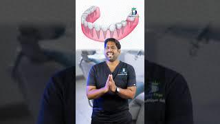 Cost of Dental Implant in India ft.@AmericasLifestyleWithRJ  - பல் பதியத்தின் விலை எவ்வளவு?