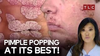 The Most Intense Cases Dr Lee Has Ever Handled! | Dr Pimple Popper TLC