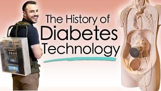 The History of Diabetes Tech