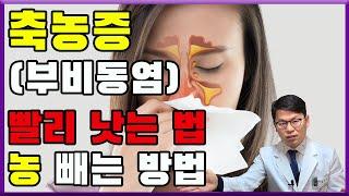 축농증(부비동염) 진단과 치료 | 이비인후과 의사가 추천하는 축농증(부비동염) 빨리 낫는 방법 | 오공작가