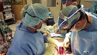 Life in the OR: Open heart surgery