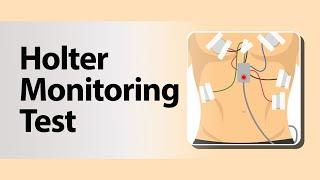 Holter Monitoring Test