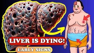 Is Your Liver Dying? 17 Critical Symptoms You Must Know! | Healthy Care