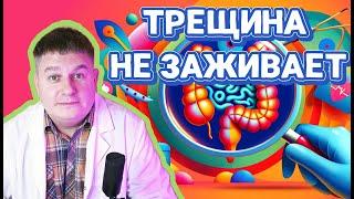 Откровенная правда: почему ваша анальная трещина не заживает? Проктолог открывает тайны!