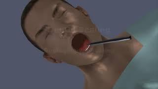 Dental Simulator - Dental Scaling