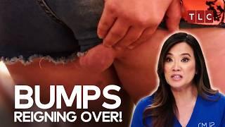 When Bumps Take Over an Entire Body! | Dr Pimple Popper TLC