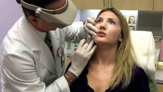 Juvederm Lip Filler | Total Dermatology