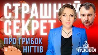 Лікар Василь Чайка дає найкращий засіб проти грибка! Грибок нігтів легко лікується!