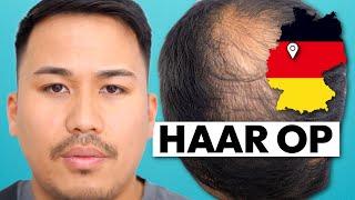 Beratung zur Haartransplantation in Deutschland | Minh's Erfahrung