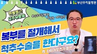 배로 하는 척추수술( ALIF// OLIF ), 타이거 우즈는 이 수술을 받고나서 복귀하여  마스터스 대회에서 우승까지 하였다.   전방접근 수술팀 ,이형창 원장님 부산 우리들병원