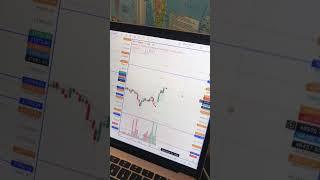 Aj ho Gaya loss #trading