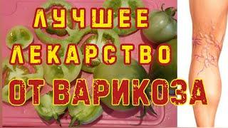 Варикозные вены,сосудистая сеточка легко излечиваются. Самое доступное лечение