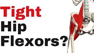 The 2 Step Approach for Tight Hip Flexors