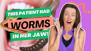 How I Cured the WORMS IN HER JAW!!!