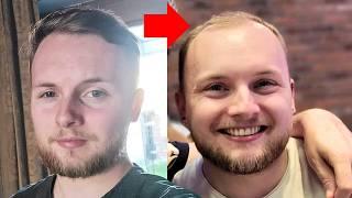 BALDING AT 23 - It's Time To SHAVE My HEAD BALD