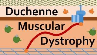 Duchenne Muscular Dystrophy and Dystrophin